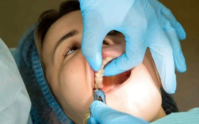 Remèdes de grand-mère après extraction dentaire : soulager naturellement la douleur