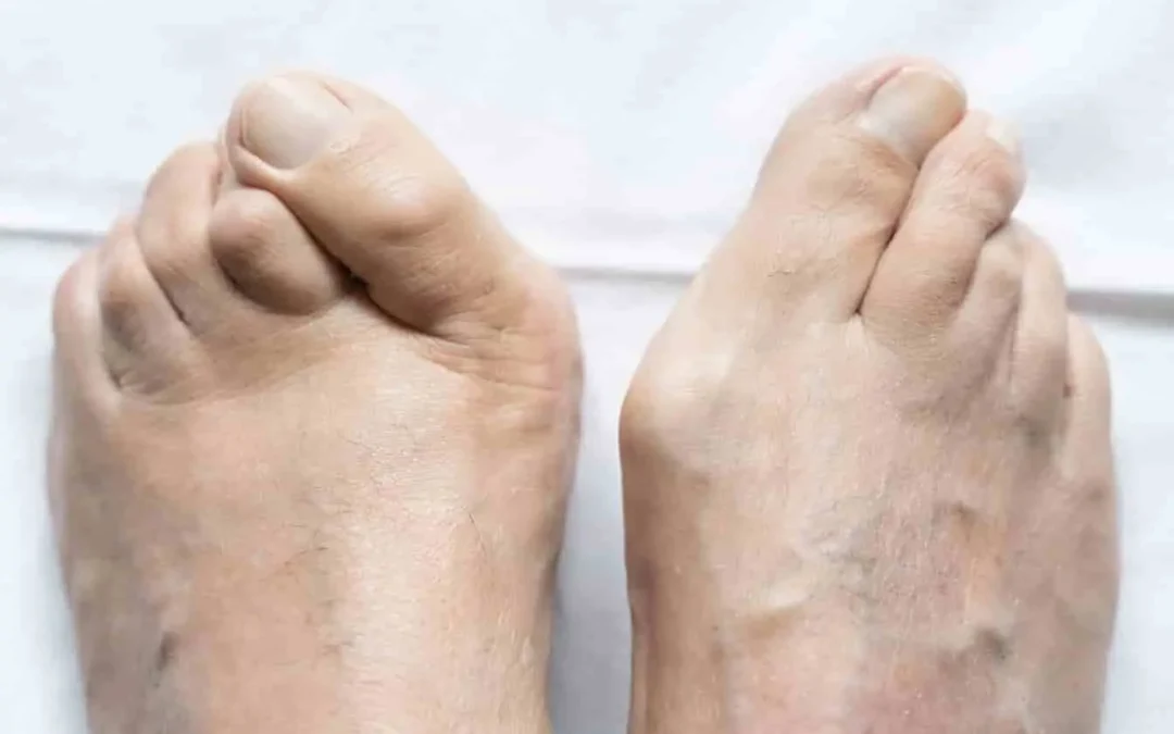 « J&rsquo;ai des pieds moches » : Comment vaincre ce complexe et avoir de beaux pieds soignés ?