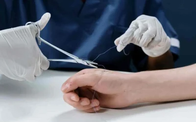 Point de suture oublié : quels sont les risques et les conséquences ?