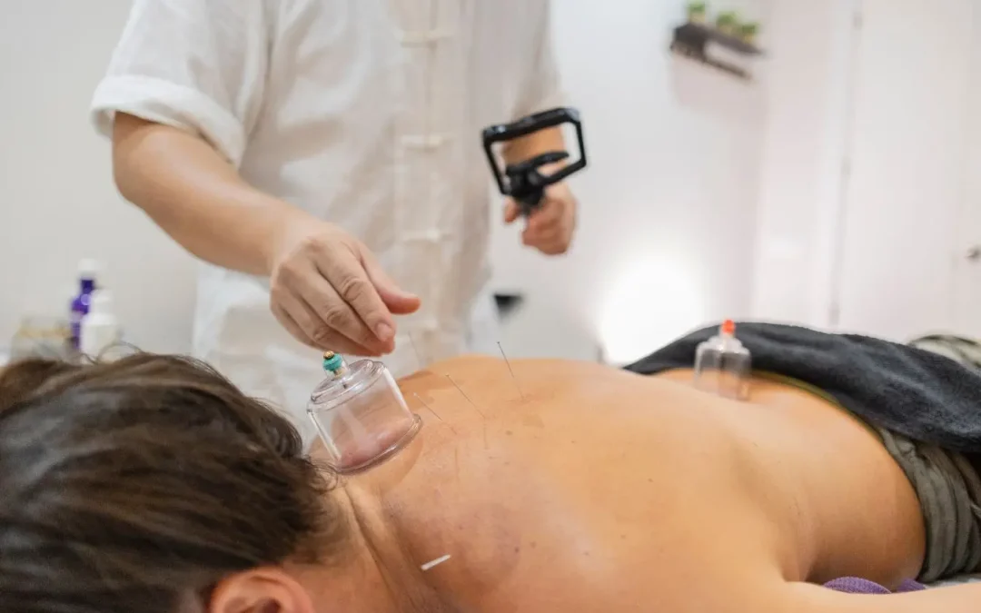 Point d&rsquo;acupuncture : localisation, bienfaits et fonctions en médecine chinoise