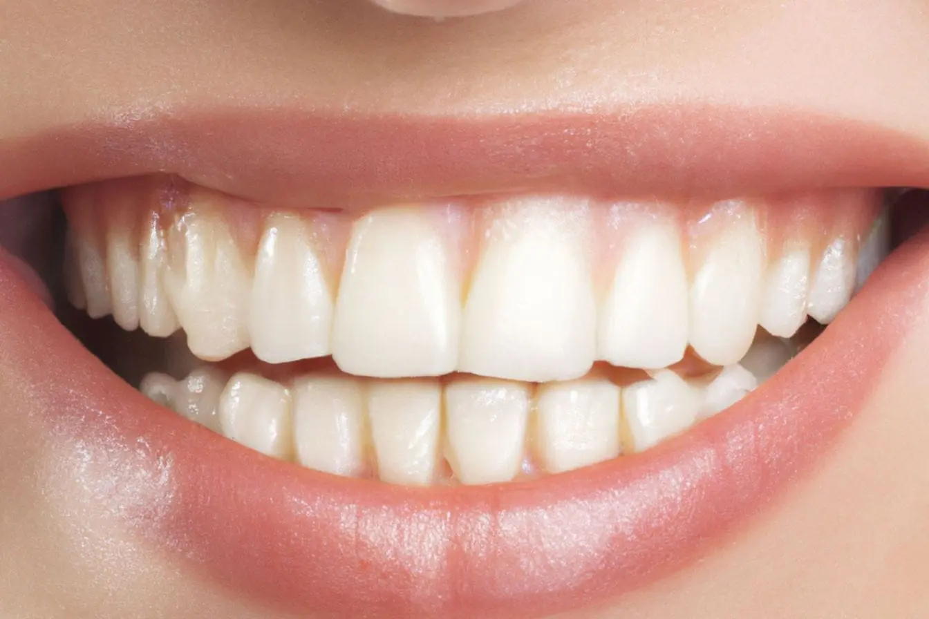 dents blanches Gros plan sur bouche avec dents blanches et gencives saines, reflet d’une bonne santé bucco-dentaire.