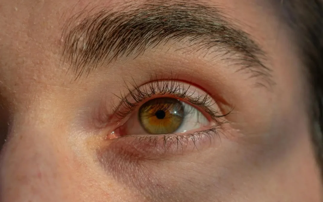 Comment soigner une conjonctivite naturellement ? Méthodes et remèdes doux