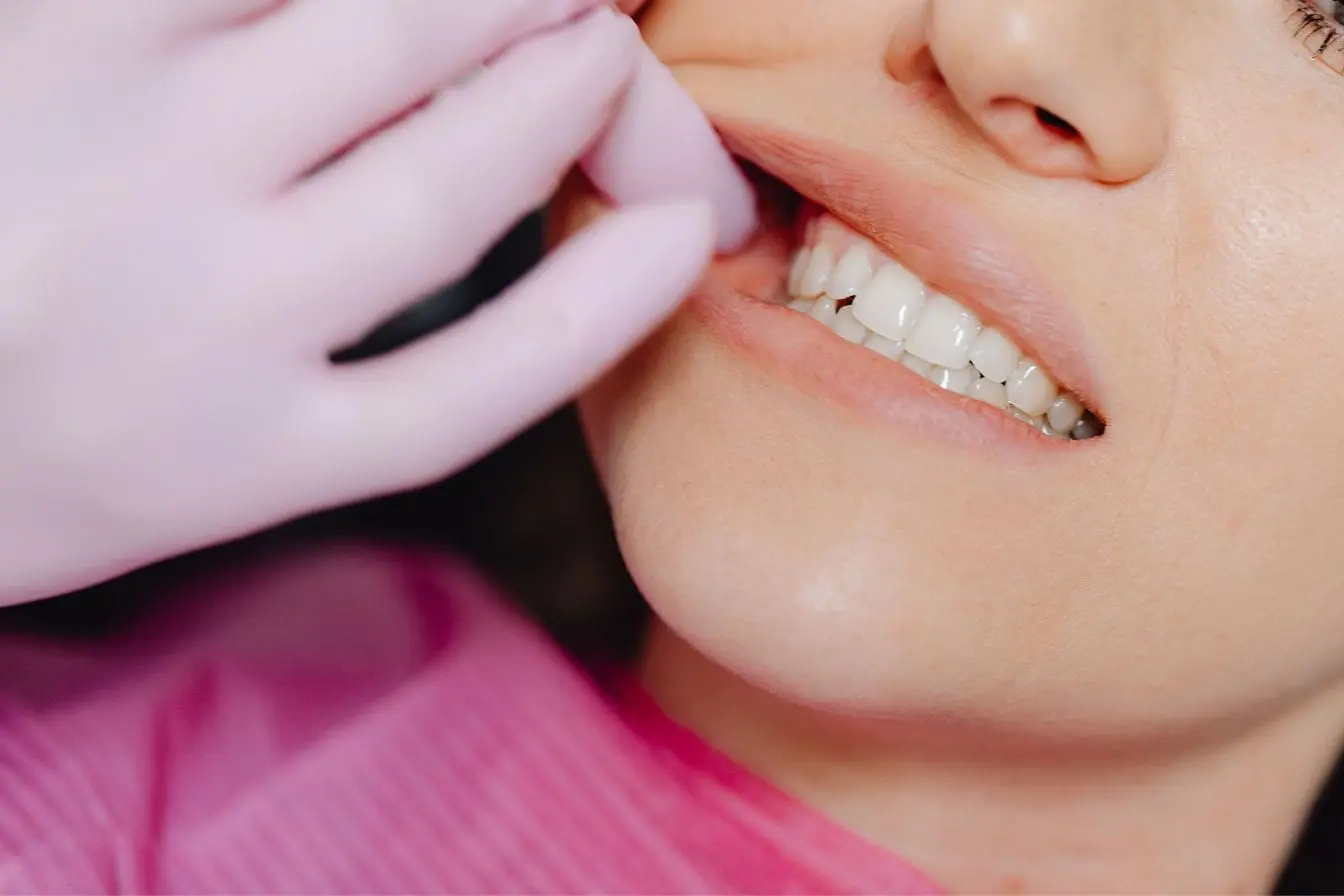 traiter un abcès dentaire Gros plan sur bouche examinée par dentiste avec gants roses, reflet des soins nécessaires pour traiter un abcès dentaire.