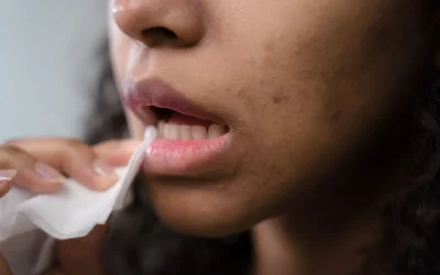 Comment soigner un aphte rapidement ? Solutions et remèdes efficaces